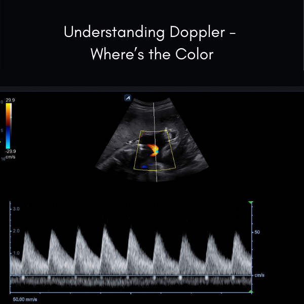 Color Doppler