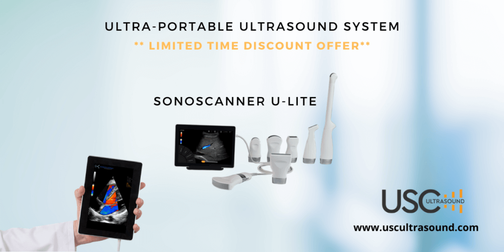 handheld ultrasound