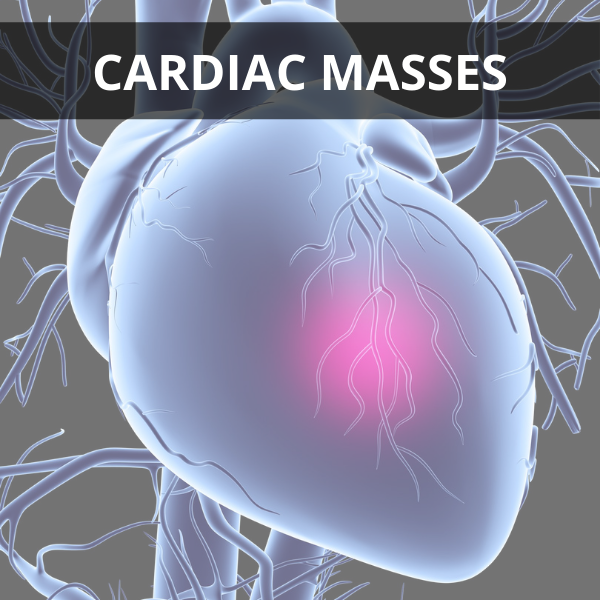 Cardiac Masses