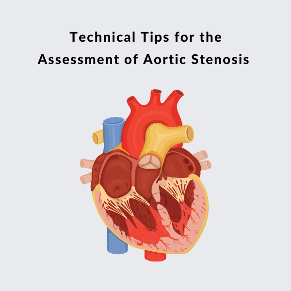 Aortic Stenosis