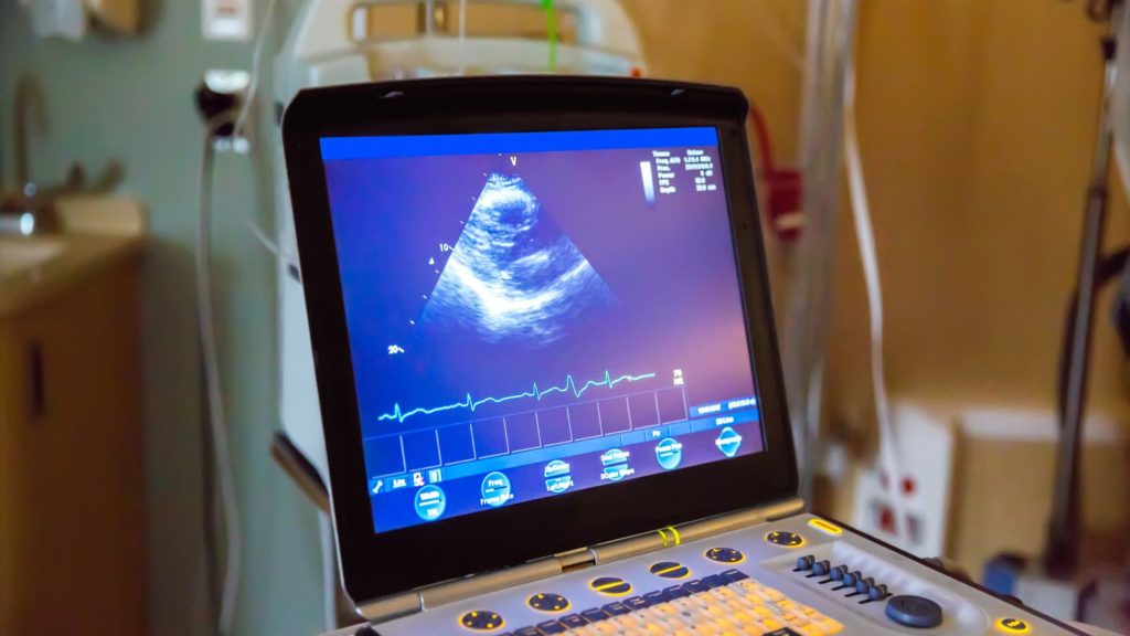 Doppler Ultrasound Machines