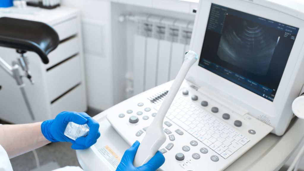 Transvaginal Ultrasound
