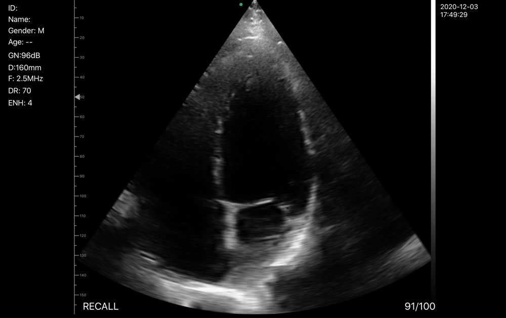 WTIO-1 Wireless Transducer ultrasound
