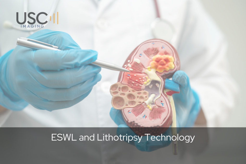 ESWL and Lithotripsy
